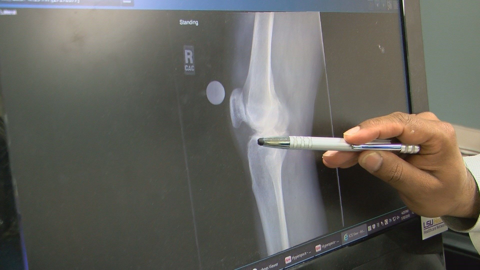 Home improvement injuries during Masters perparation. (wfxg)