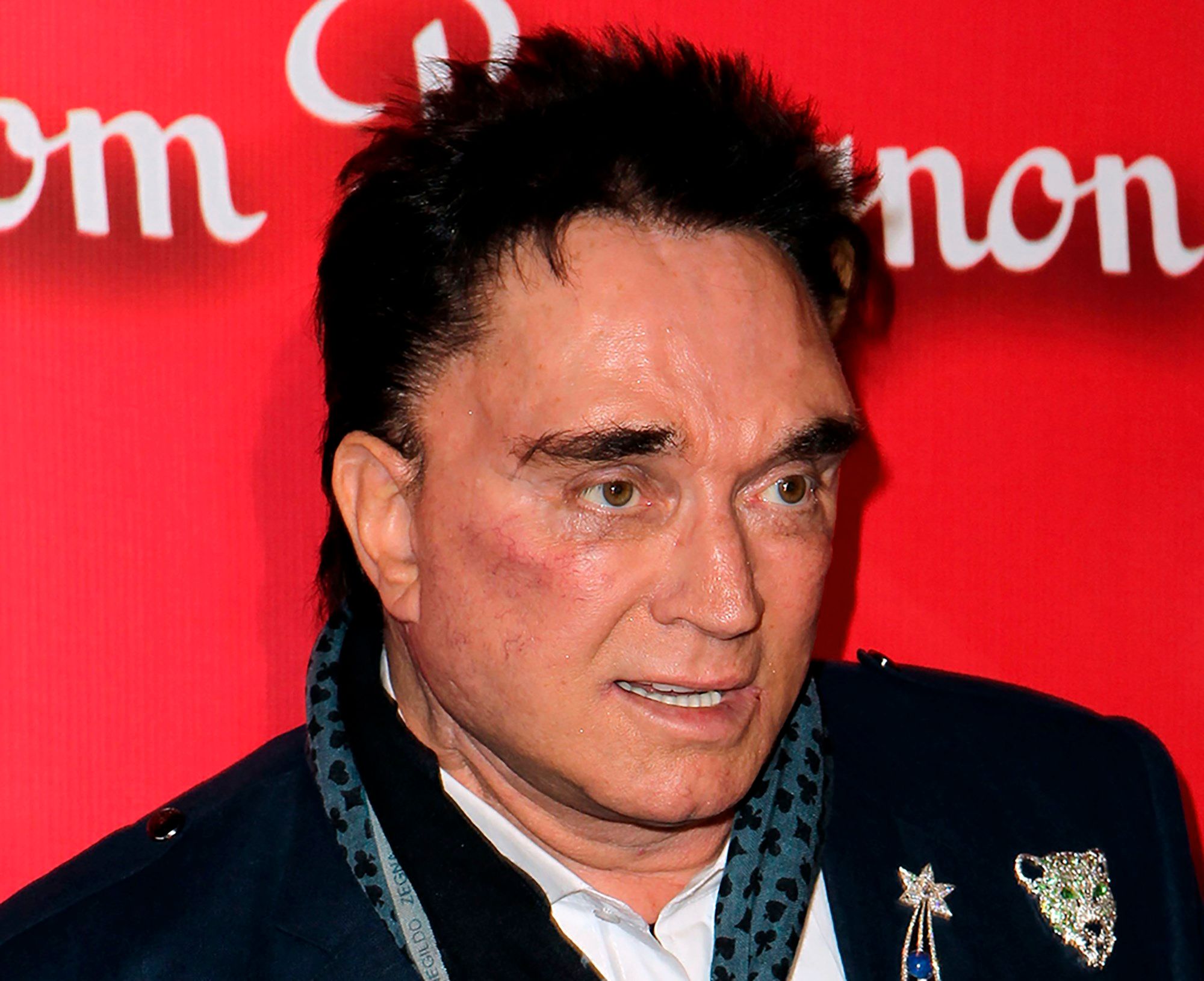 Roy Horn of Siegfried & Roy dies from coronavirus at 75 - WFXG